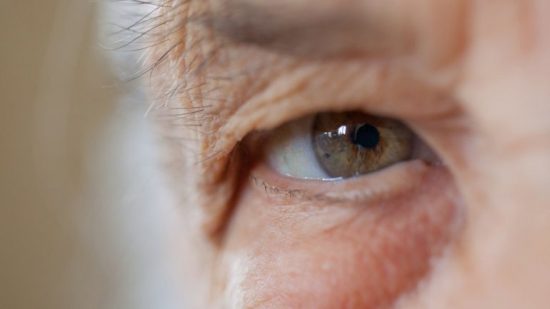 El glaucoma es una de las principales causas de ceguera en el mundo