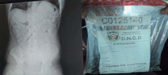 Atrapan venezolano en el AILA con 84 bolsitas de cocaína