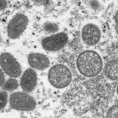OMS da nuevos nombres a variantes de virus viruela símica
