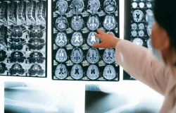 ¿Qué sucede en el cerebro al morir? La ciencia lo explica