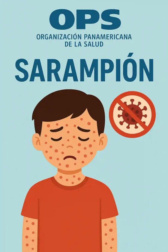 OPS: Diez países de las Américas reportan brotes de sarampión en 2025 OPS: Diez países de las Américas reportan brotes de sarampión en 2025