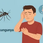 Salud Pública descarta brote de chikungunya en RD